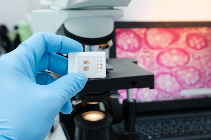 Santé : et si le cancer devenait réversible ? Une découverte majeure en Corée du Sud