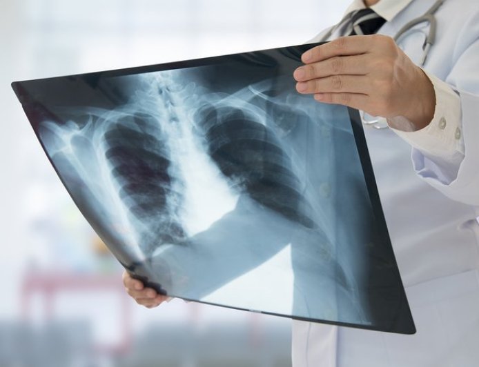 Lutte contre le cancer : des chercheurs mettent au point une méthode alternative contre les biopsies douloureuses