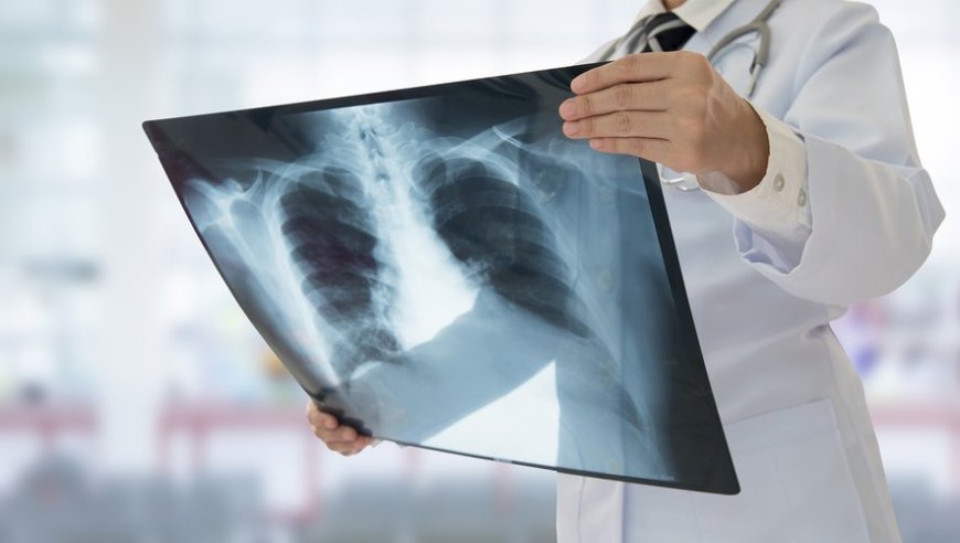 Lutte contre le cancer : des chercheurs mettent au point une méthode alternative contre les biopsies douloureuses