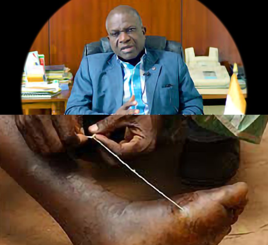 Ver de Guinée-Dr Koffi Kouamé (Coordonnateur du Programme national de lutte contre le ver de Guinée) : « Ce programme a permis de recenser et de notifier 12 690 cas dans 503 localités du pays »