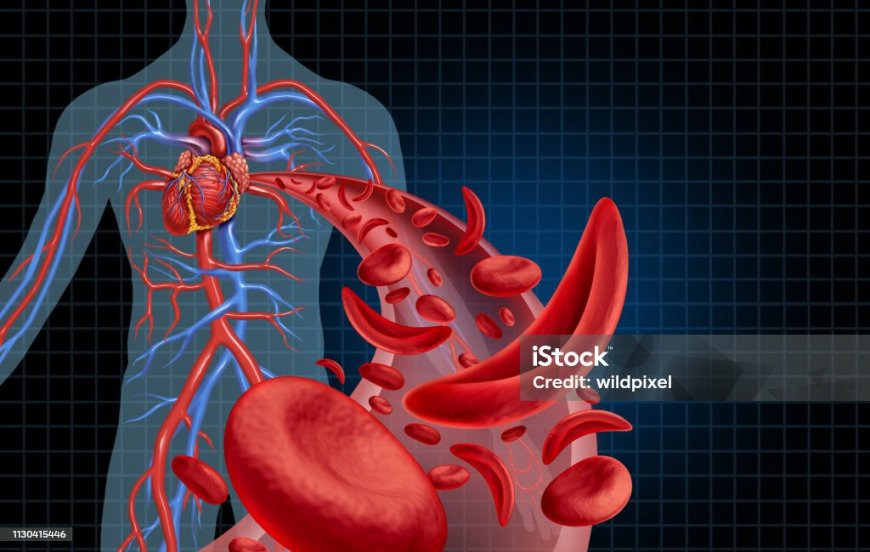 Drépanocytose : une étude révèle de nouvelles pistes thérapeutiques grâce à la métabolomique
