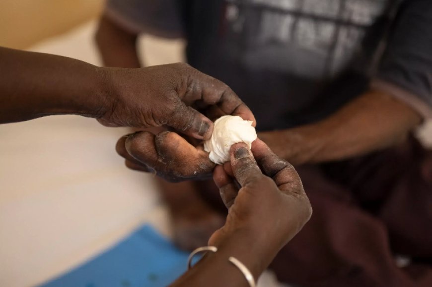 Afrique du Sud : les autorités sud-africaines et l’OMS s’unissent pour mener une riposte contre la lèpre dans le pays